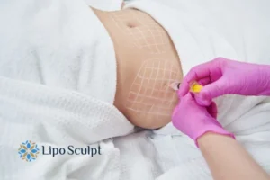 Are The Results From Aqualyx Permanent? 1 Do you want to know how long Aqualyx Cambridge results last?