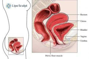 Treatment For A Leaky Bladder 2 How EM Chair treatment Cambridge can help Leaky bladder issues. Read more now!