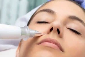 Best Actinic Keratoses Removal 3 Actinic keratoses Cambridge solutions - book in today!